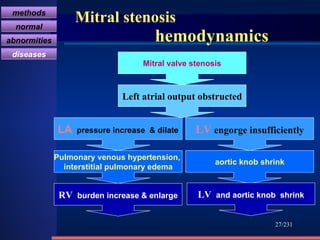 Mitral stenosis    hemodynamics /231 Mitral valve stenosis Left atrial output obstructed LV  engorge insufficiently LA   pressure increase  & dilate Pulmonary venous hypertension,  interstitial pulmonary edema RV  burden increase & enlarge aortic knob shrink LV  and aortic knob  shrink methods normal abnormities diseases 