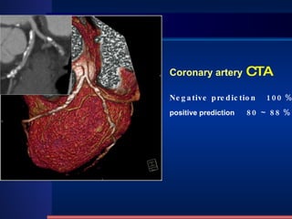 Coronary artery   CTA Negative prediction  100 ％ positive prediction  80 ～ 88 ％ 