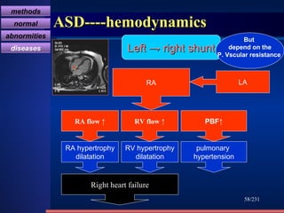 ASD----hemodynamics /231 Left -> right shunt But  depend on the P. Vscular resistance  RA LA RA flow  ↑ RV flow  ↑ PBF↑ RA hypertrophy dilatation RV hypertrophy dilatation pulmonary  hypertension Right heart failure methods normal abnormities diseases 