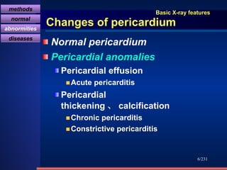 Basic X-ray features Changes of pericardium Normal pericardium Pericardial anomalies Pericardial effusion Acute pericarditis Pericardial thickening 、 calcification Chronic pericarditis Constrictive pericarditis /231 methods normal abnormities diseases 
