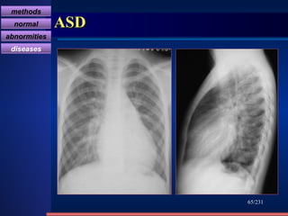 ASD /231 methods normal abnormities diseases 