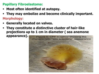 Papillary Fibroelastoma:
 Most often identified at autopsy.
 They may embolize and become clinically important.
Morphology:
 Generally located on valves.
 They constitute a distinctive cluster of hair-like
projections up to 1 cm in diameter ( sea anemone
appearance).
 