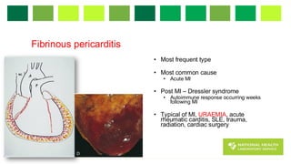 PericardialDiseaseBH_2025 hhhhhhhhhhh1.pdf