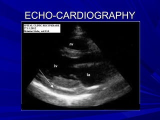 ECHO-CARDIOGRAPHYECHO-CARDIOGRAPHY
 