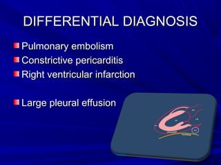 DIFFERENTIAL DIAGNOSISDIFFERENTIAL DIAGNOSIS
Pulmonary embolismPulmonary embolism
Constrictive pericarditisConstrictive pericarditis
Right ventricular infarctionRight ventricular infarction
Large pleural effusionLarge pleural effusion
 