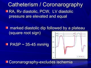 Catheterism / CoronarographyCatheterism / Coronarography
RA, Rv diastolic, PCW, LV diastolicRA, Rv diastolic, PCW, LV diastolic
pressure are elevated and equalpressure are elevated and equal
marked diastolic dip followed by a plateaumarked diastolic dip followed by a plateau
(square root sign)(square root sign)
PASPPASP ~ 35-45 mmHg~ 35-45 mmHg
Coronarography-excludes ischemiaCoronarography-excludes ischemia
 