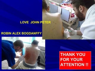THANK YOU
FOR YOUR
ATTENTION !!
ROBIN ALEX BOGDANFFY
LOVE JOHN PETER
 