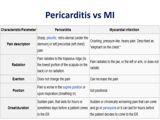 Pericarditis vs MI
 