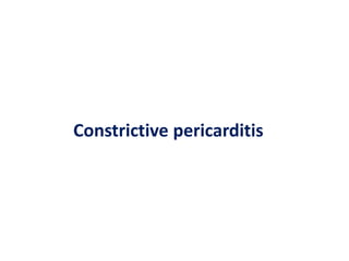 Constrictive pericarditis
 