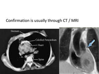 Confirmation is usually through CT / MRI
 