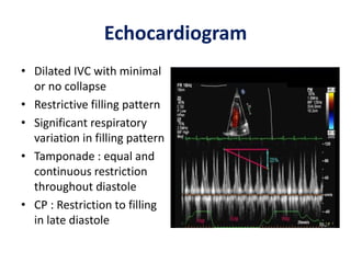 Echocardiogram
• Dilated IVC with minimal
or no collapse
• Restrictive filling pattern
• Significant respiratory
variation in filling pattern
• Tamponade : equal and
continuous restriction
throughout diastole
• CP : Restriction to filling
in late diastole
 