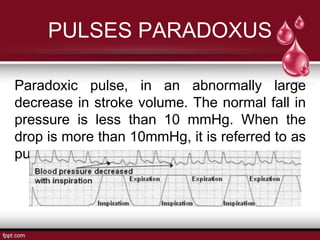 PULSES PARADOXUS
Paradoxic pulse, in an abnormally large
decrease in stroke volume. The normal fall in
pressure is less than 10 mmHg. When the
drop is more than 10mmHg, it is referred to as
pulses paradoxus.
 