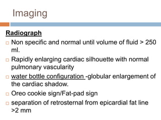 Imaging of Pericardial effusion | PPTX