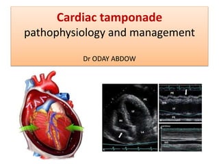 Cardiac tamponade
pathophysiology and management
Dr ODAY ABDOW
 