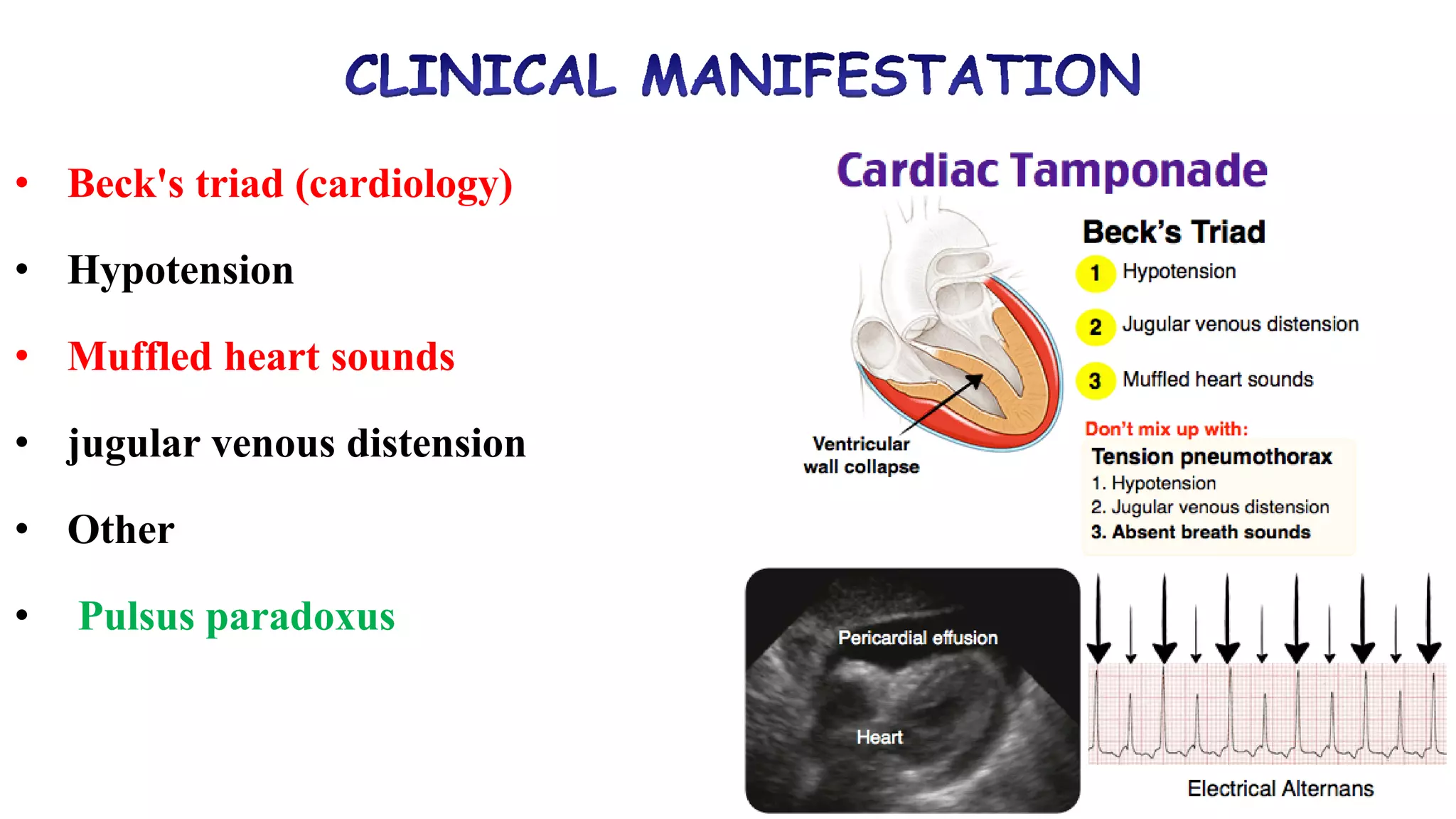 PERICARDIAL TEMPONADE drmousa.pdf