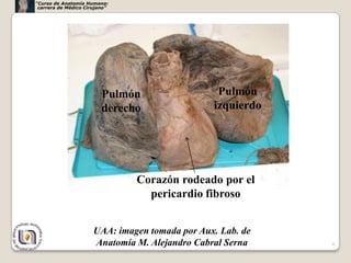 “Curso de Anatomía Humana:
 carrera de Médico Cirujano”




                         Pulmón                  Pulmón
                         derecho                izquierdo




                               Corazón rodeado por el
                                 pericardio fibroso


                      UAA: imagen tomada por Aux. Lab. de
                      Anatomía M. Alejandro Cabral Serna    4
 