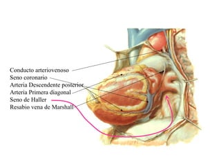 Conducto arteriovenoso
Seno coronario
Arteria Descendente posterior
Arteria Primera diagonal
Seno de Haller
Resabio vena de Marshall