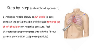 Paraxiphoid Pericardiocentesis | PDF