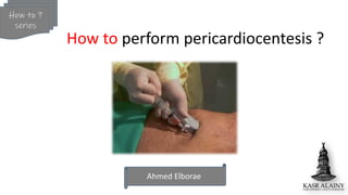 Ahmed Elborae
How to ?
series
How to perform pericardiocentesis ?
 