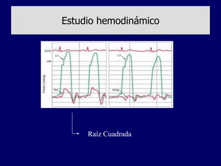 Estudio hemodinámico




     Raíz Cuadrada
 