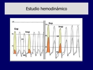 Estudio hemodinámico
 
