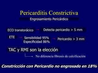 Pericarditis Constrictiva
                 Engrosamiento Pericárdico


   ECO transtorácico         Detecta pericardio > 5 mm

    ETE      Sensibilidad 95%           Pericardio > 3 mm
             Especificidad 86%

   TAC y RMI son la elección
                       No diferencia fibrosis de calcificación


Constricción con Pericardio no engrosado en 18%
 