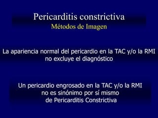 Pericarditis constrictiva
                 Métodos de Imagen


La apariencia normal del pericardio en la TAC y/o la RMI
               no excluye el diagnóstico



     Un pericardio engrosado en la TAC y/o la RMI
             no es sinónimo por sí mismo
               de Pericarditis Constrictiva
 