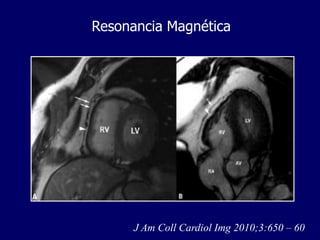 Resonancia Magnética




    J Am Coll Cardiol Img 2010;3:650 – 60
      J Am Coll Cardiol Img 2010;3:650 – 60
 
