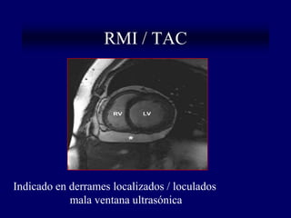 RMI / TAC




Indicado en derrames localizados / loculados
            mala ventana ultrasónica
 