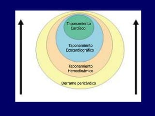Taponamiento
    Cardíaco



   Taponamiento
  Ecocardiográfico



   Taponamiento
   Hemodinámico


Derrame pericárdico
 