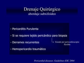 Drenaje Quirúrgico
               abordaje subxifoideo



- Pericarditis Purulenta

- Si se requiere tejido pericárdico para biopsia

- Derrames recurrentes                   Guiado por pericardioscopio
                                                  flexible

- Hemopericardio traumático



                    Pericardial diseases. Guidelines ESC 2004
 