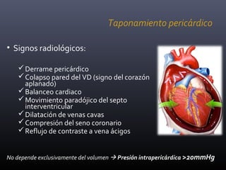 Taponamiento pericárdico
• Signos radiológicos:
Derrame pericárdico
Colapso pared del VD (signo del corazón
aplanado)
Balanceo cardiaco
Movimiento paradójico del septo
interventricular
Dilatación de venas cavas
Compresión del seno coronario
Reflujo de contraste a vena ácigos
No depende exclusivamente del volumen  Presión intrapericárdica >20mmHg
 