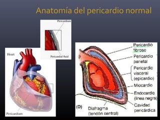 Anatomía del pericardio normal
 
