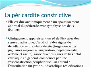 La péricardite constrictive Elle est due anatomiquement à un épaississement anormal du péricarde avec symphyse des deux feuillets.  Cliniquement apparaissent un sd de Pick avec des signes d'adiastolie, c'est-à-dire des signes de défaillance ventriculaire droite (turgescence des jugulaires majorée à l’inspiration, hépatomégalie, œdème et ascite), associés à des signes de bas débit cardiaque en général, compensés par une vasoconstriction périphérique. On entend à l’auscultation un 3 ème  bruit diastolique (calcification) 