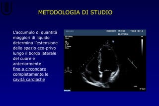 METODOLOGIA DI STUDIO
L’accumulo di quantità
maggiori di liquido
determina l’estensione
dello spazio eco-privo
lungo il bordo laterale
del cuore e
anteriormente
fino a circondare
completamente le
cavità cardiache
 