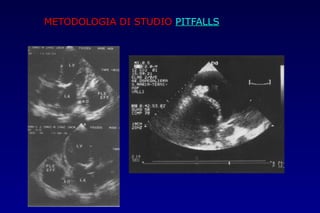 METODOLOGIA DI STUDIOMETODOLOGIA DI STUDIO PITFALLSPITFALLS
 