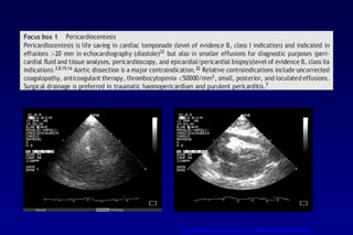 ESC Guidelines Eur Heart J. 2004 Apr;25(7):587-610
 