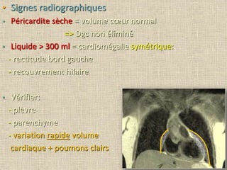 • Signes radiographiques
• Péricardite sèche = volume cœur normal
=> Dgc non éliminé
• Liquide > 300 ml = cardiomégalie symétrique:
- rectitude bord gauche
- recouvrement hilaire
• Vérifier:
- plèvre
- parenchyme
- variation rapide volume
cardiaque + poumons clairs
 