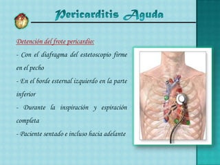 Pericarditis Aguda	- Irradiación: Sin irradiación y en ocasiones irradia a cuello, hombro izquierdo, espalda y omoplato.	- Agravantes : Tos, movimientos respiratorios especialmente la inspiración profunda, deglución, movimientos laterales de tórax y decúbito dorsal.	  Atenuantes: Inclinación hacia adelante, decúbito prono, 	respiración artificial.	- Duración - Recurrencia: De horas a varios días