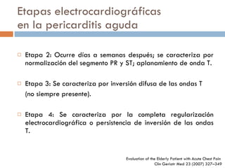 Etapas electrocardiográficas en la pericarditis aguda Etapa 2: Ocurre días a semanas después; se caracteriza por normalización del segmento PR y ST; aplanamiento de onda T. Etapa 3: Se caracteriza por inversión difusa de las ondas T (no siempre presente).   Etapa 4: Se caracteriza por la completa regularización electrocardiográfica o persistencia de inversión de las ondas T. Evaluation of the Elderly Patient  with Acute Chest Pain  Clin Geriatr Med 23 (2007) 327–349 