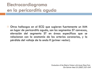 Electrocardiograma en la pericarditis aguda Otros hallazgos en el ECG que sugieren fuertemente un IAM en lugar de pericarditis aguda, son los segmentos ST convexos, elevación del segmento ST en áreas especificas que se relacionan con la anatomía de las arterias coronarias, y la pérdida del voltaje de la onda R (primer vector). Evaluation of the Elderly Patient  with Acute Chest Pain  Clin Geriatr Med 23 (2007) 327–349 