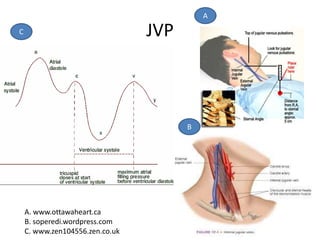 JVP
A. www.ottawaheart.ca
B. soperedi.wordpress.com
C. www.zen104556.zen.co.uk
C
B
A
 