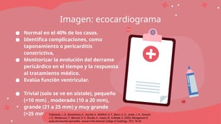 Imagen: ecocardiograma
NEXT
PREV
● Normal en el 40% de los casos.
● Identifica complicaciones, como
taponamiento o pericarditis
constrictiva,
● Monitorizar la evolución del derrame
pericárdico en el tiempo y la respuesta
al tratamiento médico.
● Evalúa función ventricular.
● Trivial (solo se ve en sístole), pequeño
(<10 mm) , moderado (10 a 20 mm),
grande (21 a 25 mm) y muy grande
(>25 mm). Chiabrando, J. G., Bonaventura, A., Vecchié, A., Wohlford, G. F., Mauro, A. G., Jordan, J. H., Grizzard,
J. D., Montecucco, F., Berrocal, D. H., Brucato, A., Imazio, M., & Abbate, A. (2020). Management of
acute and recurrent pericarditis. Journal of the American College of Cardiology, 75(1), 76–92
 