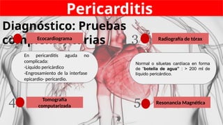 Pericarditis
Diagnóstico: Pruebas
complementarias
Ecocardiograma
2
En pericarditis aguda no
complicada:
-Líquido pericárdico
-Engrosamiento de la interfase
epicardio- pericardio.
Radiografía de tórax
3
Normal o siluetas cardíaca en forma
de “botella de agua” : > 200 ml de
líquido pericárdico.
Resonancia Magnética
Tomografía
computarizada 5
4
 
