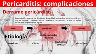 Pericarditis: complicaciones
Derrame pericárdico
Acumulación anormal de líquido en la cavidad pericárdica, superior a 50 ml,
que se produce como respuesta a una lesión del pericario parietal por todas
las causas de pericarditis aguda.
Leve Severo
Moderado
Etiología
Infecciones
Lesión pericárdica
Idiopatica
Metabólicas
Cáncer
Insuficiencia
cardíaca
 