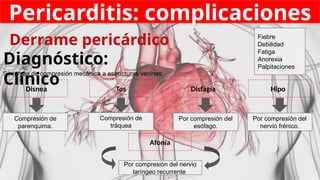 Pericarditis: complicaciones
Derrame pericárdico
Diagnóstico:
Clínico
Síntomas de compresión mecánica a estructuras vecinas:
Disnea
Afonía
Tos Disfagia Hipo
Compresión de
parenquima.
Compresión de
tráquea
Por compresión del
esófago.
Por compresión del
nervio frénico.
Por compresión del nervio
laríngeo recurrente
Fiebre
Debilidad
Fatiga
Anorexia
Palpitaciones
 