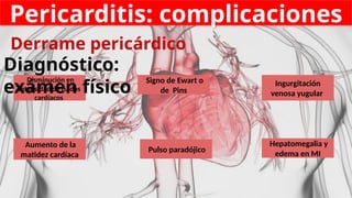 Pericarditis: complicaciones
Derrame pericárdico
Ingurgitación
venosa yugular
Signo de Ewart o
de Pins
Aumento de la
matidez cardíaca
Hepatomegalia y
edema en MI
Disminución en
intensidad de ruidos
cardíacos
Pulso paradójico
Diagnóstico:
exámen físico
 