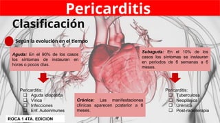 Pericarditis
Clasificación
Según la evolución en el tiempo
Aguda: En el 90% de los casos
los síntomas de instauran en
horas o pocos días.
Subaguda: En el 10% de los
casos los síntomas se instauran
en periodos de 6 semanas a 6
meses.
Crónica: Las manifestaciones
clínicas aparecen posterior a 6
meses.
Pericarditis:
❏ Tuberculosa
❏ Neoplásica
❏ Urémica
❏ Post-radioterapia
Pericarditis:
❏ Aguda idiopática
❏ Vírica
❏ Infecciones
❏ Enf. Autoinmunes
ROCA 1 4TA. EDICION
 
