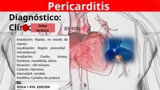 Pericarditis
Diagnóstico:
Clínico
Instalación: Rápida, en estado de
reposo.
Localización: Región precordial
retroesternal.
Irradiación: Cuello, brazos,
hombros, mandíbula, dorso.
Duración: >30 minutos.
Carácter: Opresivo.
Intensidad: variable.
Modifica: Cambios de postura.
Dolor
torácico 85-90%
1
ROCA 1 4TA. EDICION
 