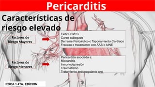 Pericarditis
Características de
riesgo elevado
Factores de
Riesgo Mayores
Factores de
Riesgo Menores
Fiebre >38°C
Curso subagudo
Derrame Pericárdico o Taponamiento Cardíaco
Fracaso a tratamiento con AAS o AINE
Pericarditis asociada a:
Miocarditis
Inmunodepresión
Traumatismo
Tratamiento anticoagulante oral
ROCA 1 4TA. EDICION
 